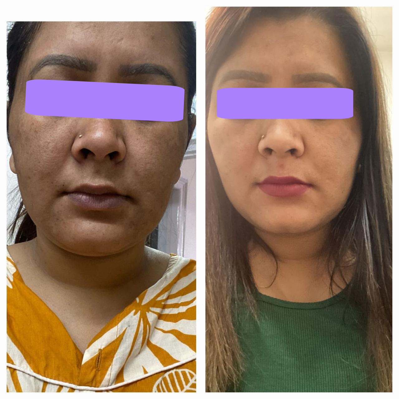 {"remix_data":[],"remix_entry_point":"challenges","source_tags":["local"],"origin":"unknown","total_draw_time":0,"total_draw_actions":0,"layers_used":0,"brushes_used":0,"photos_added":0,"total_editor_actions":{},"tools_used":{"brushes":1},"is_sticker":false,"edited_since_last_sticker_save":true,"containsFTESticker":false}