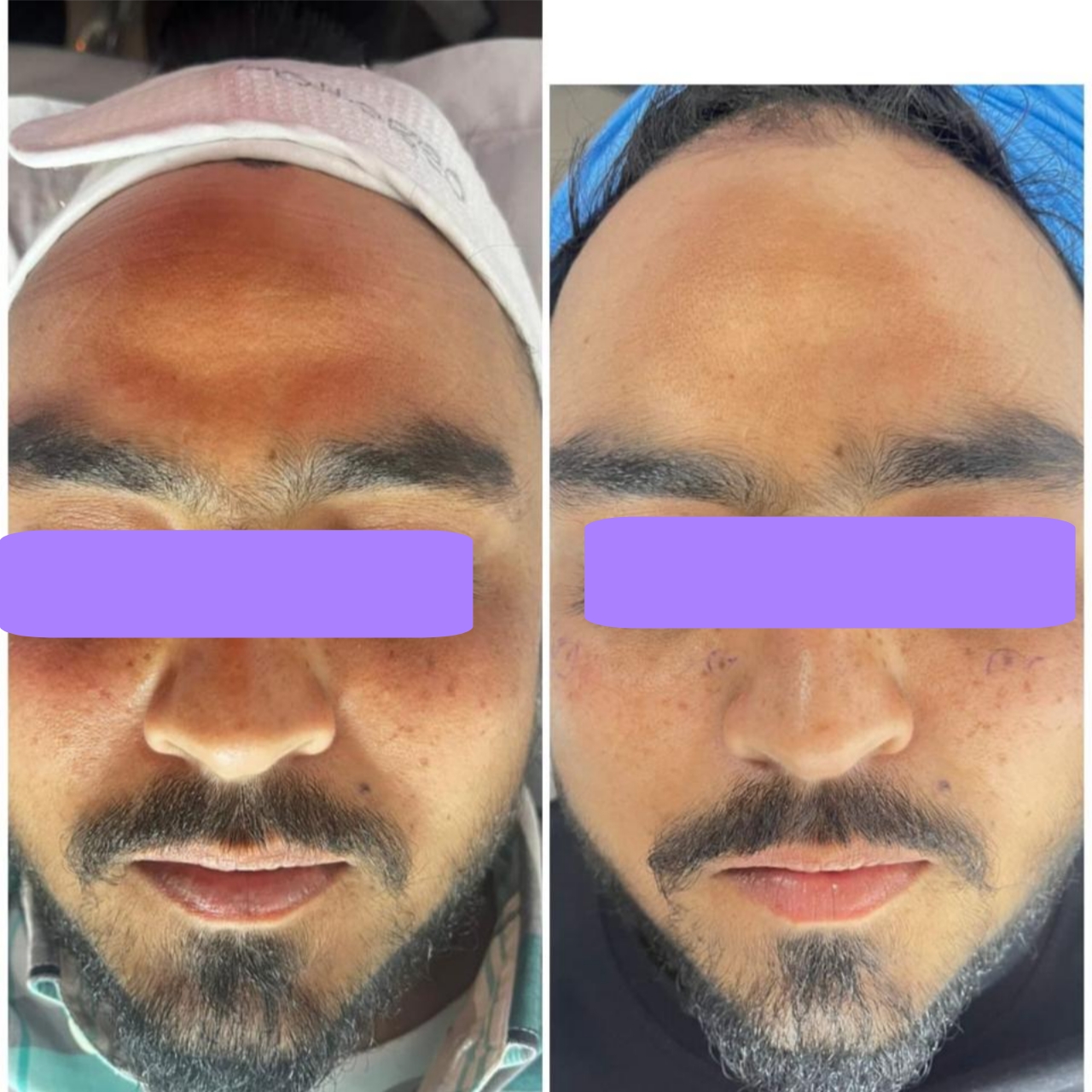 {"remix_data":[],"remix_entry_point":"challenges","source_tags":["local"],"origin":"unknown","total_draw_time":0,"total_draw_actions":0,"layers_used":0,"brushes_used":0,"photos_added":0,"total_editor_actions":{},"tools_used":{"brushes":1},"is_sticker":false,"edited_since_last_sticker_save":true,"containsFTESticker":false}