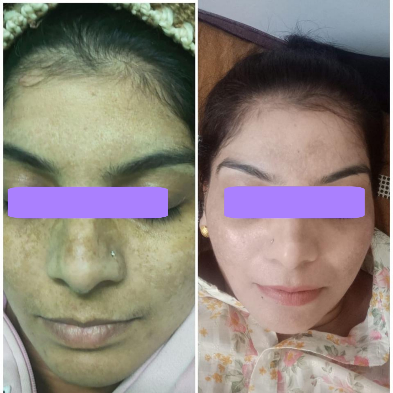 {"remix_data":[],"remix_entry_point":"challenges","source_tags":["local"],"origin":"unknown","total_draw_time":0,"total_draw_actions":0,"layers_used":0,"brushes_used":0,"photos_added":0,"total_editor_actions":{},"tools_used":{"brushes":1},"is_sticker":false,"edited_since_last_sticker_save":true,"containsFTESticker":false}